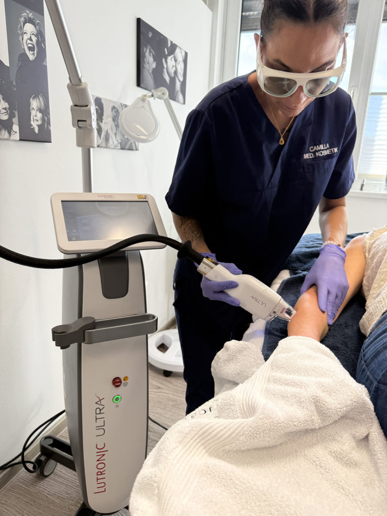 Eine Frau führt eine Laserbehandlung an dem Arm einer Frau durch