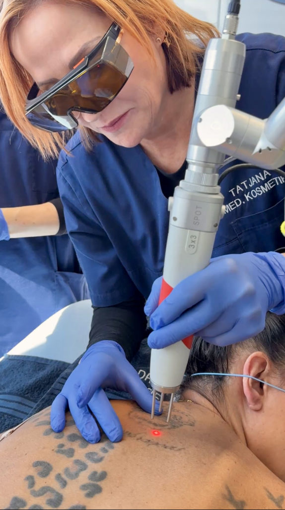 etwas nähere Aufnahme der Dame, die die Tattoo-Entfernung mit dem Laser durchführt
